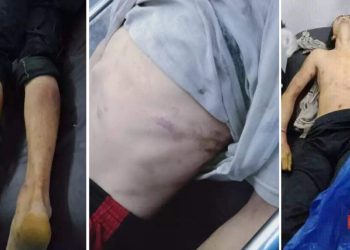 प्रहरीले पक्राउ परेका युवकको प्रहरी हिरासतमा मृत्यु