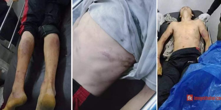 प्रहरीले पक्राउ परेका युवकको प्रहरी हिरासतमा मृत्यु